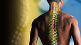 Spine Surgery